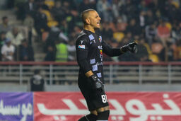 چه بلایی سر حامد لک آمد؟ خودش می‌گوید «اسکارفیس» شده!