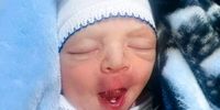 آیا ته دیگ موجب خرابی دندان‌ها می‌شود؟