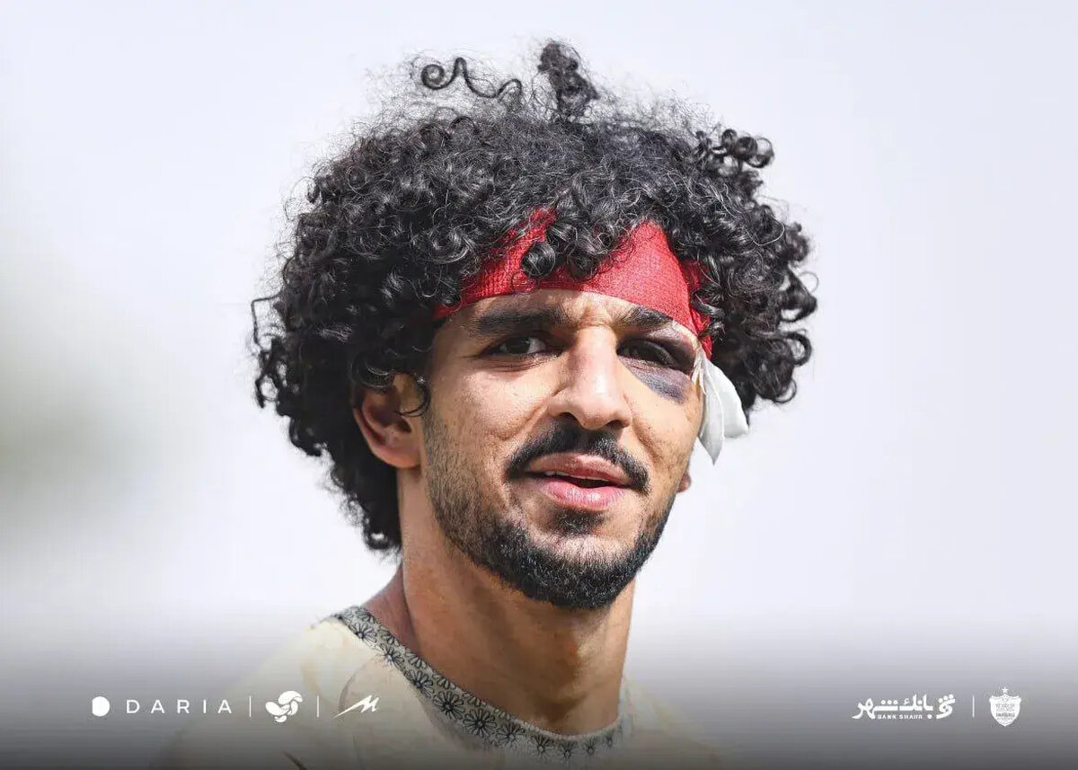 شوکه کننده: راز کبودی‌های مشکوک در تمرین پرسپولیس فاش شد! (+عکس)